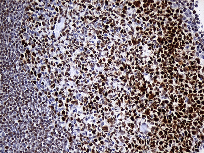 RB1 Antibody in Immunohistochemistry (Paraffin) (IHC (P))