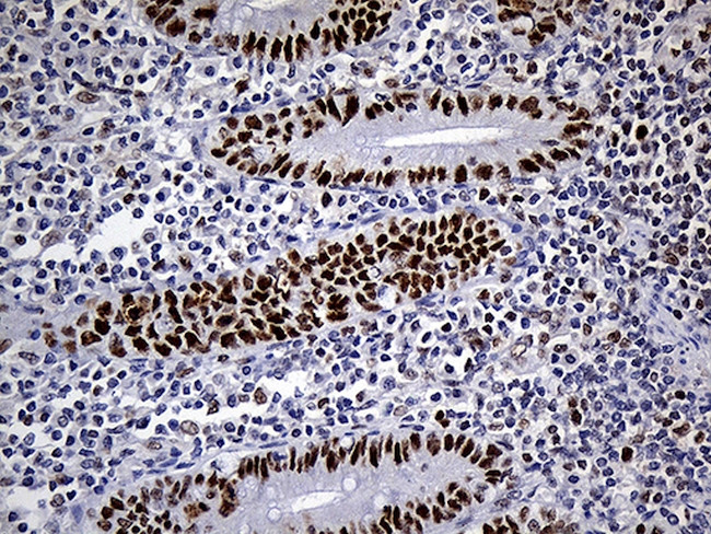 RB1 Antibody in Immunohistochemistry (Paraffin) (IHC (P))