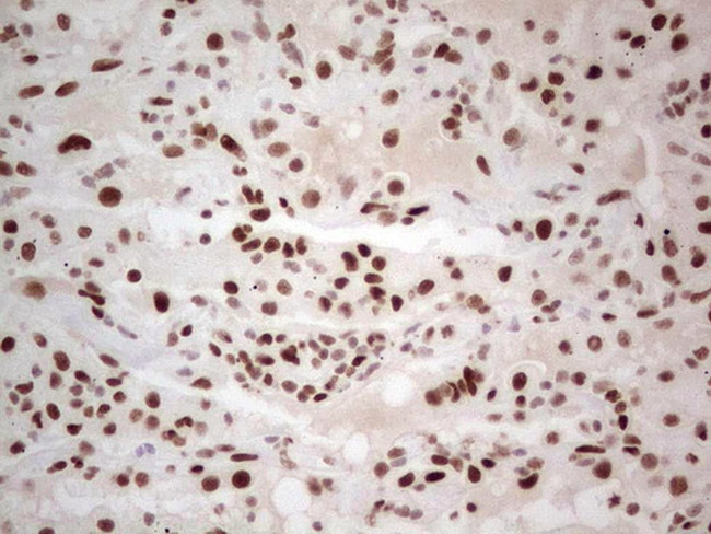 RB1 Antibody in Immunohistochemistry (Paraffin) (IHC (P))