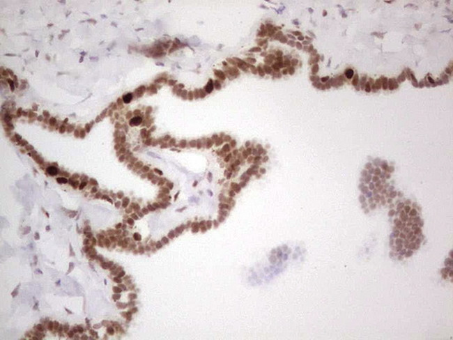 RB1 Antibody in Immunohistochemistry (Paraffin) (IHC (P))