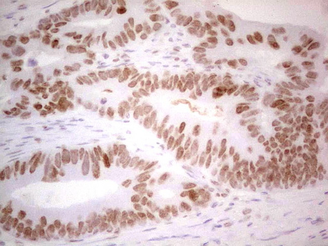 RB1 Antibody in Immunohistochemistry (Paraffin) (IHC (P))