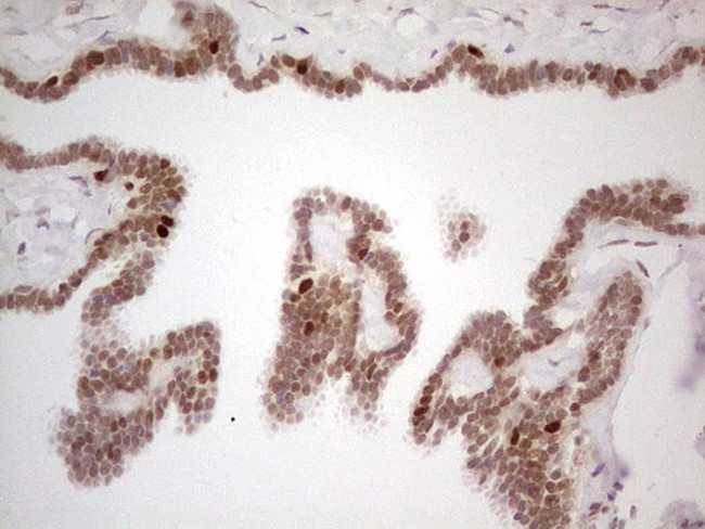 RB1 Antibody in Immunohistochemistry (Paraffin) (IHC (P))