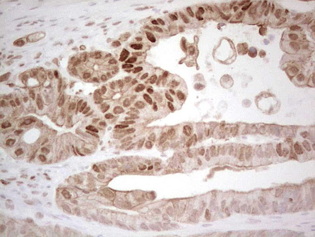 RB1 Antibody in Immunohistochemistry (Paraffin) (IHC (P))