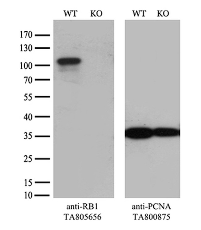 RB1 Antibody