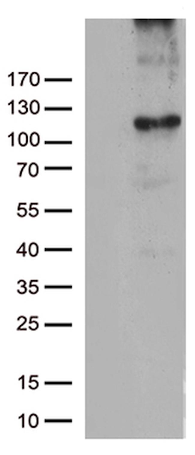 RB1 Antibody in Western Blot (WB)