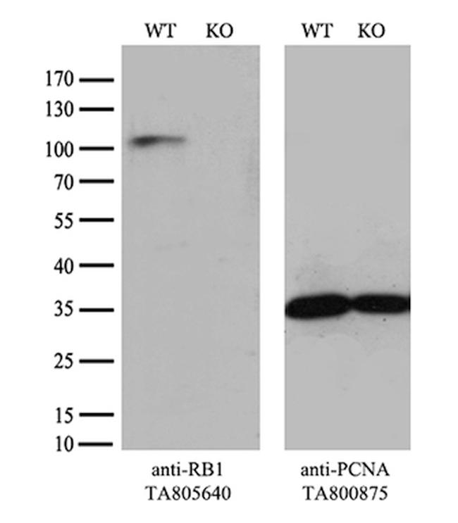 RB1 Antibody in Western Blot (WB)