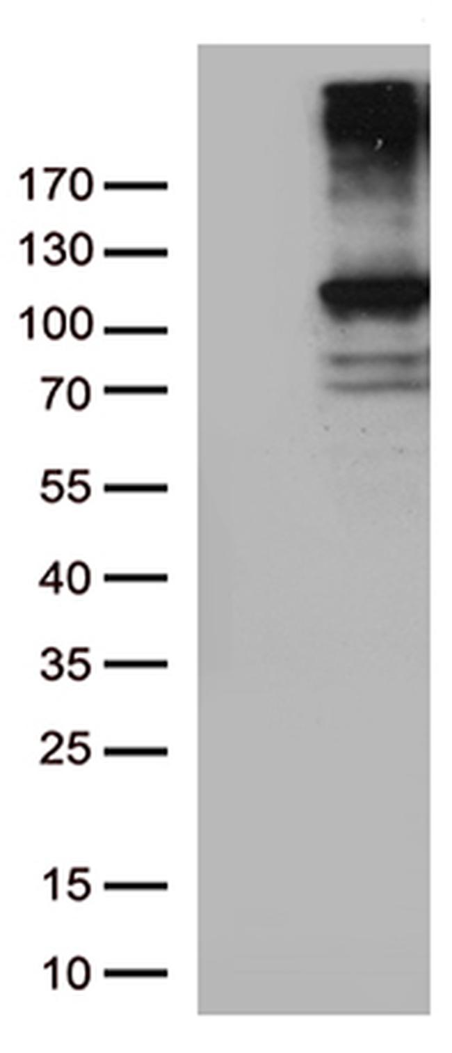 RB1 Antibody in Western Blot (WB)