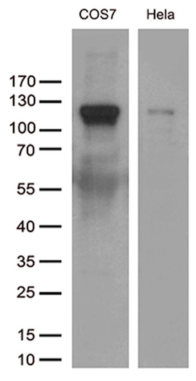 RB1 Antibody in Western Blot (WB)