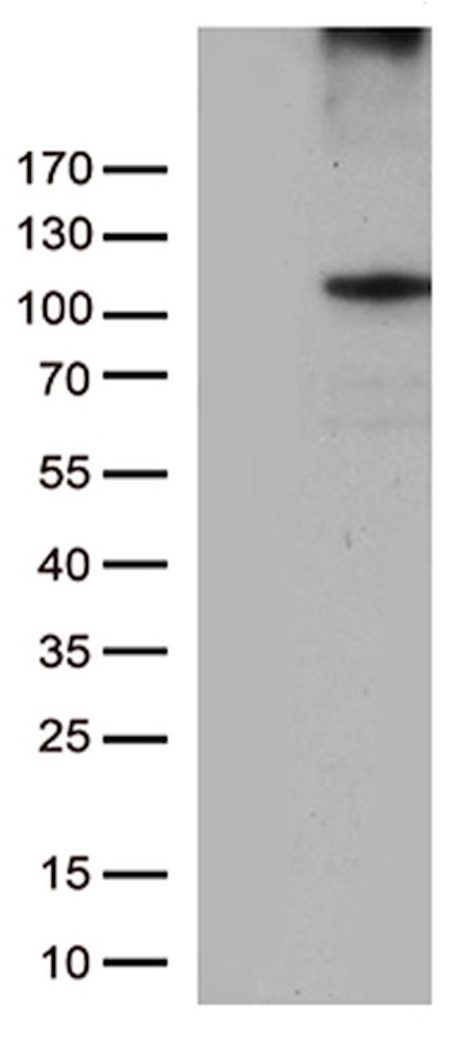 RB1 Antibody in Western Blot (WB)