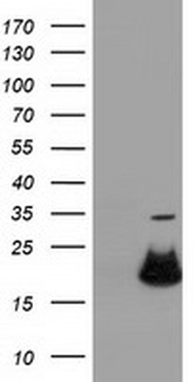 RBBP9 Antibody in Western Blot (WB)