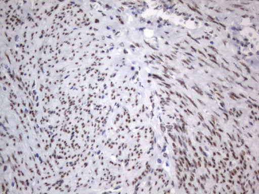 RBFOX1 Antibody in Immunohistochemistry (Paraffin) (IHC (P))