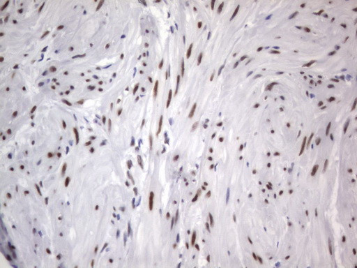 RBFOX1 Antibody in Immunohistochemistry (Paraffin) (IHC (P))