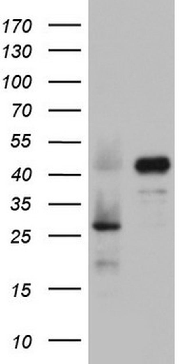 RBFOX1 Antibody in Western Blot (WB)