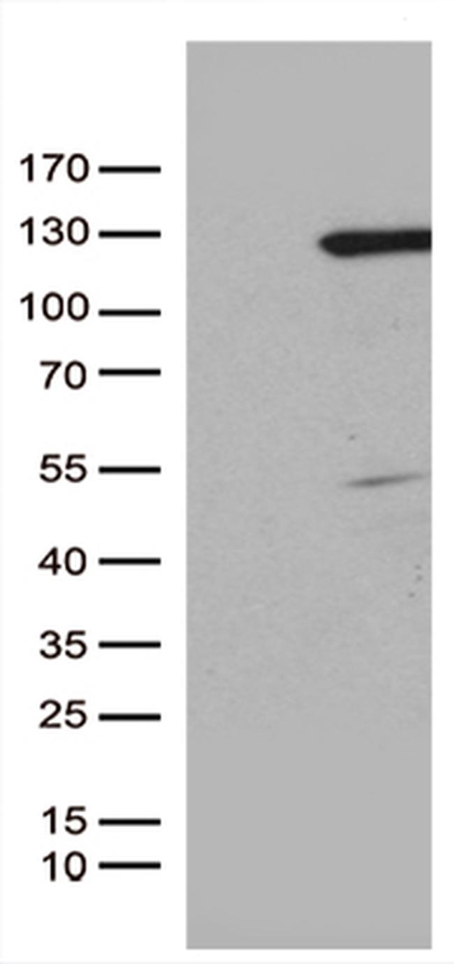 RBL1 Antibody in Western Blot (WB)