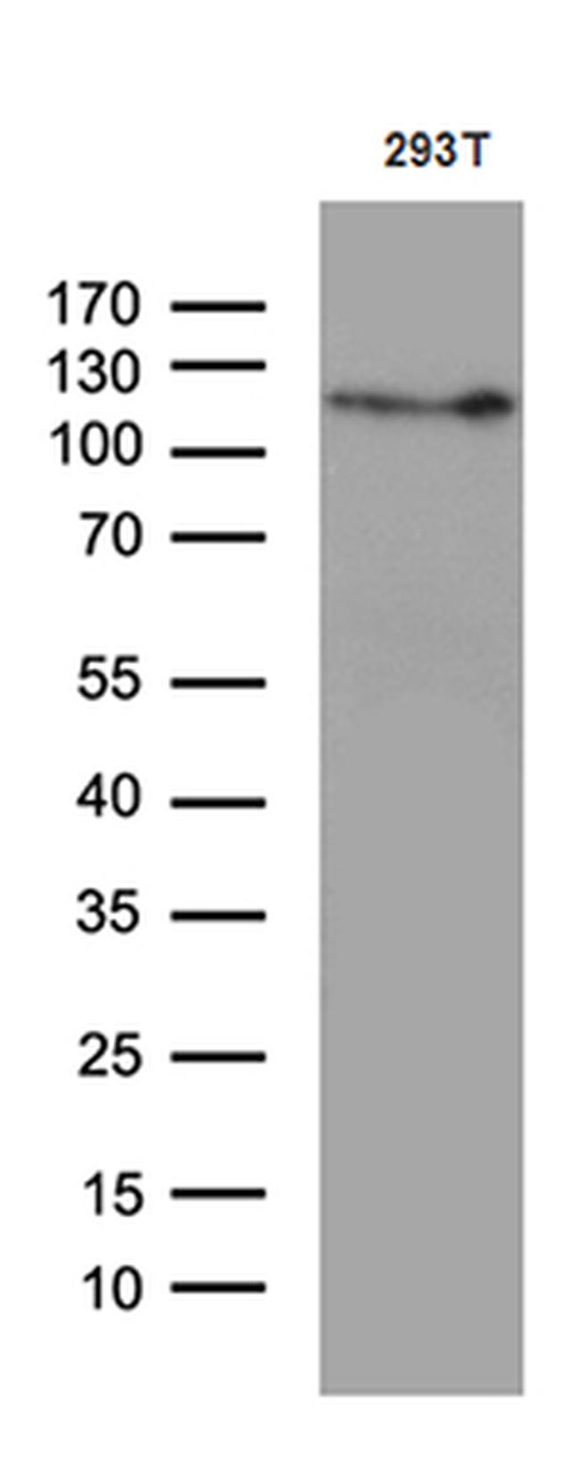 RBL1 Antibody in Western Blot (WB)