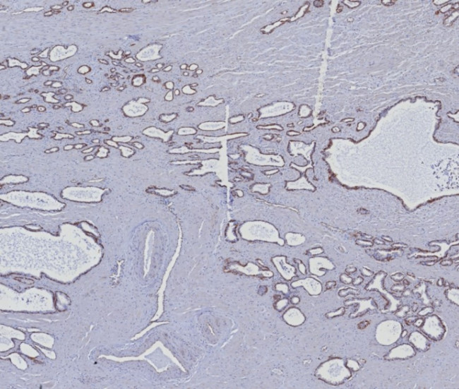 Cytokeratin 5/6 (Basal, Myoepithelial and Mesothelial Cell Marker) Antibody in Immunohistochemistry (Paraffin) (IHC (P))