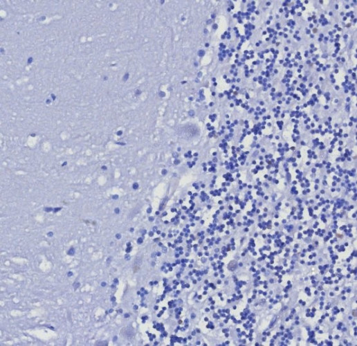 Cytokeratin 5/6 (Basal, Myoepithelial and Mesothelial Cell Marker) Antibody in Immunohistochemistry (Paraffin) (IHC (P))