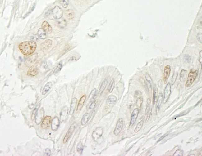 RBM10 Antibody in Immunohistochemistry (IHC)