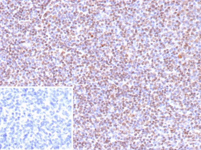 Epstein-Barr Virus (LMP-1) Antibody in Immunohistochemistry (Paraffin) (IHC (P))