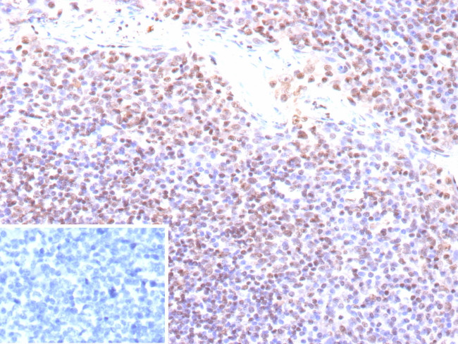 Epstein-Barr Virus (LMP-1) Antibody in Immunohistochemistry (Paraffin) (IHC (P))