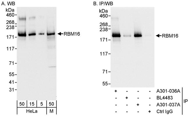 RBM16 Antibody in Western Blot (WB)