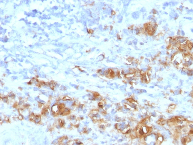 CA19-9/Sialyl Lewisa (GI Tumor Marker) Antibody in Immunohistochemistry (Paraffin) (IHC (P))