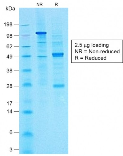 CA19-9/Sialyl Lewisa (GI Tumor Marker) Antibody in SDS-PAGE (SDS-PAGE)