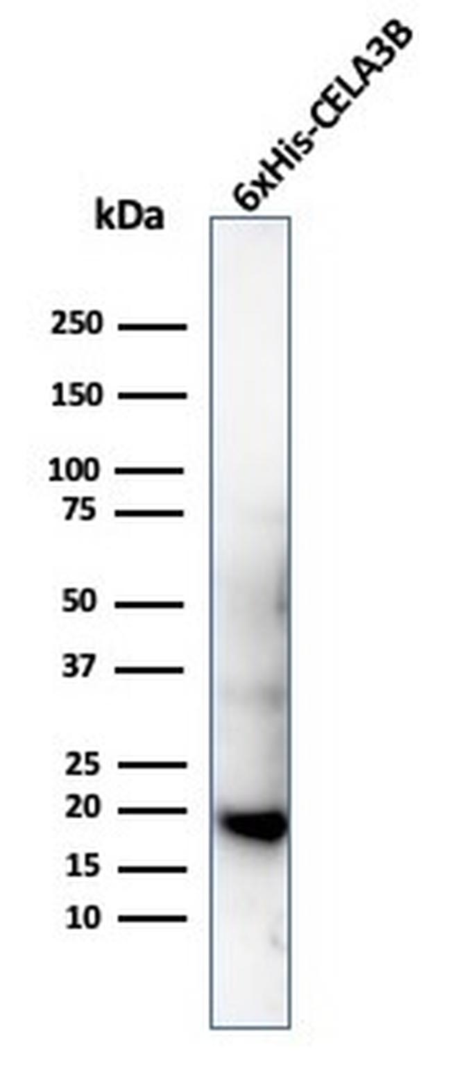 Hexa-histidine (Epitope Tag) Antibody in Western Blot (WB)