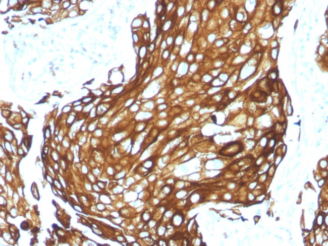 Cytokeratin, Acidic (Type I or LMW) Antibody in Immunohistochemistry (Paraffin) (IHC (P))