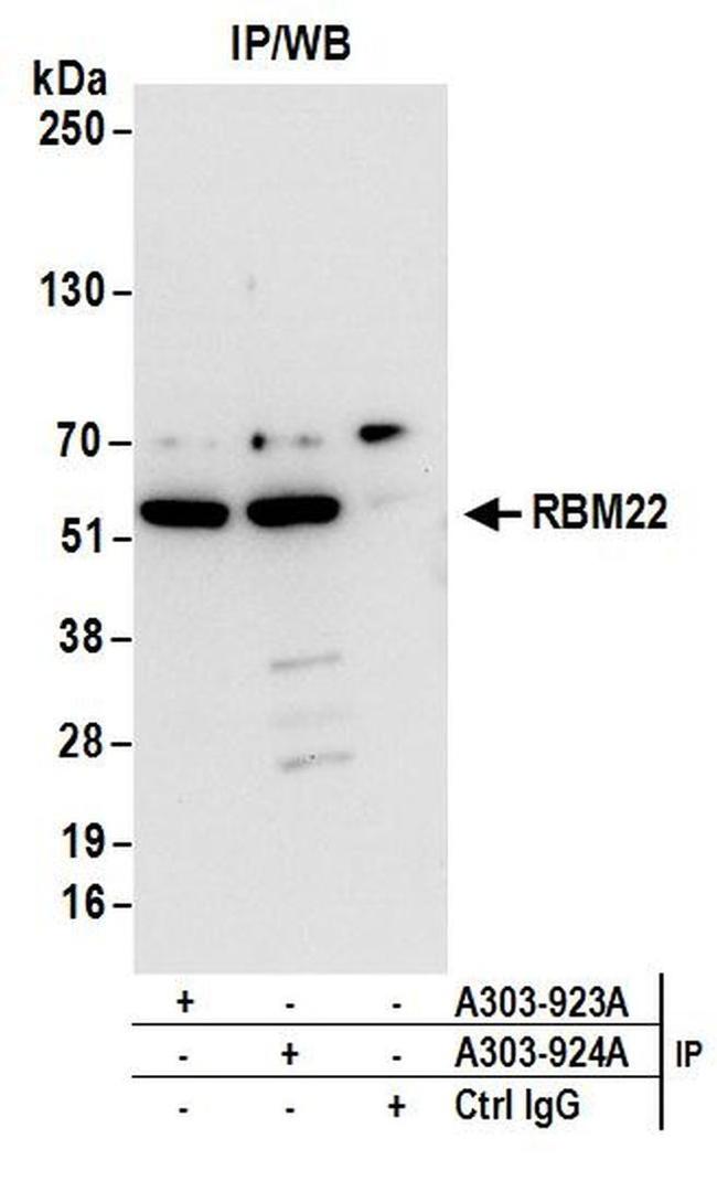 RBM22 Antibody in Western Blot (WB)