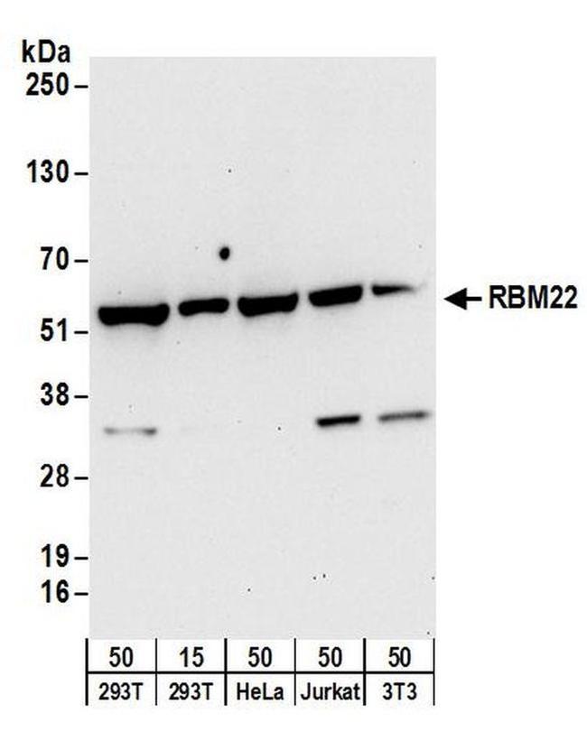 RBM22 Antibody in Western Blot (WB)
