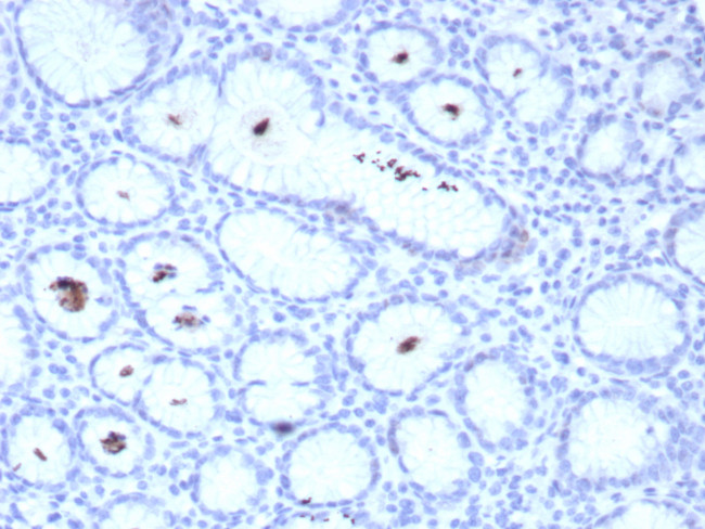 Helicobacter pylori (Catalase) Antibody in Immunohistochemistry (Paraffin) (IHC (P))