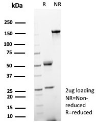 Helicobacter pylori (Catalase) Antibody in SDS-PAGE (SDS-PAGE)