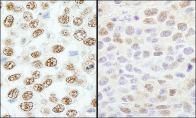 RBM25/RED120 Antibody in Immunohistochemistry (IHC)