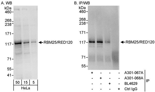 RBM25/RED120 Antibody in Western Blot (WB)