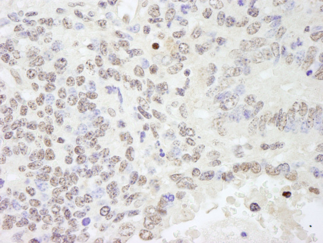 RBM25/RED120 Antibody in Immunohistochemistry (IHC)