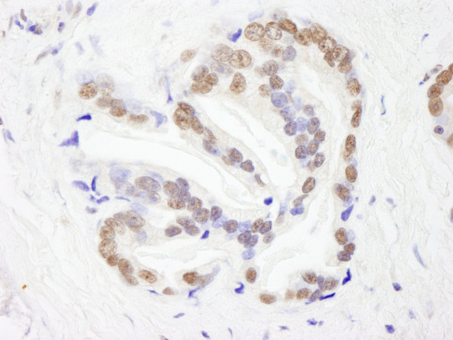 RBM26 Antibody in Immunohistochemistry (IHC)