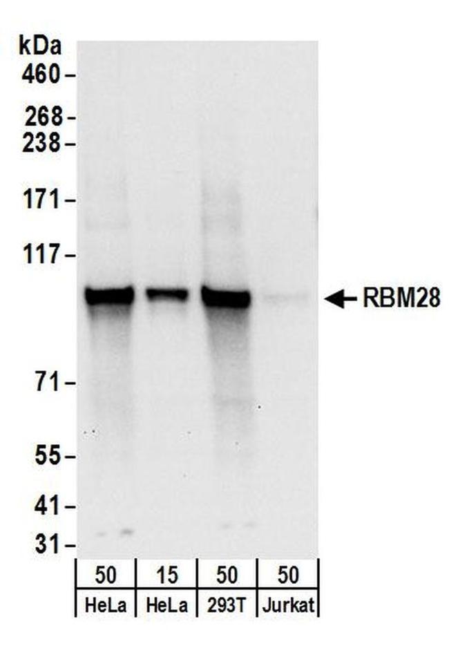 RBM28 Antibody in Western Blot (WB)