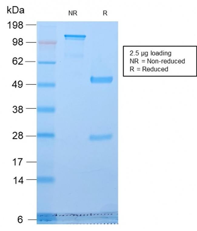 Golgi Complex Antibody in SDS-PAGE (SDS-PAGE)