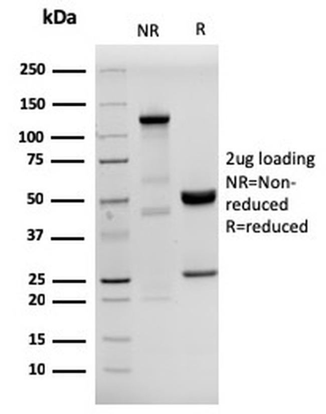 Human Herpes Virus 8 (HHV8) Antibody in SDS-PAGE (SDS-PAGE)