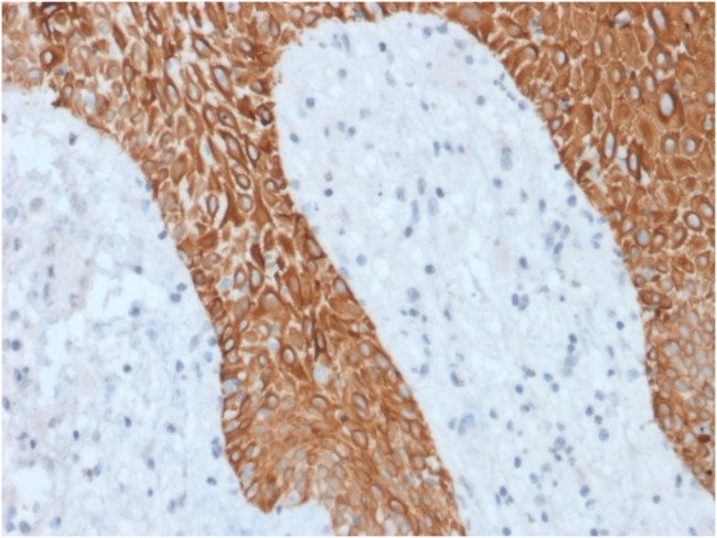 Cytokeratin, Multi (Epithelial Marker) Antibody in Immunohistochemistry (Paraffin) (IHC (P))