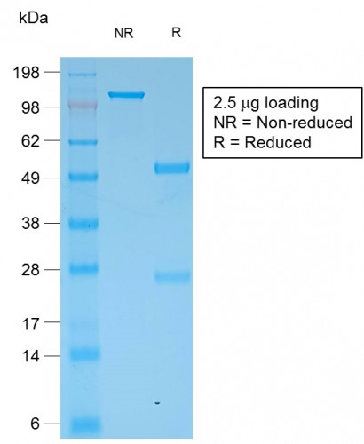 Cytokeratin, Multi (Epithelial Marker) Antibody in SDS-PAGE (SDS-PAGE)