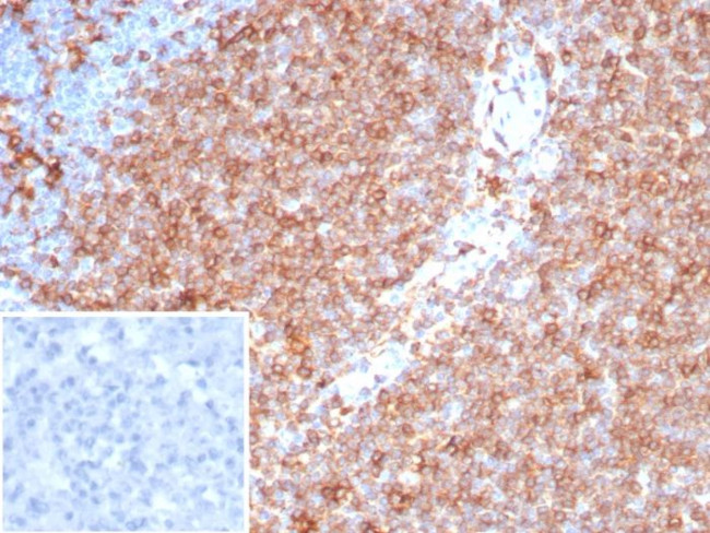 Pan-HLA-II (DP, DQ, DR) Antibody in Immunohistochemistry (Paraffin) (IHC (P))