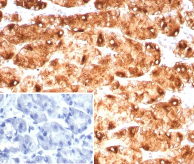 Lewis Y (Tumor Marker) Antibody in Immunohistochemistry (Paraffin) (IHC (P))