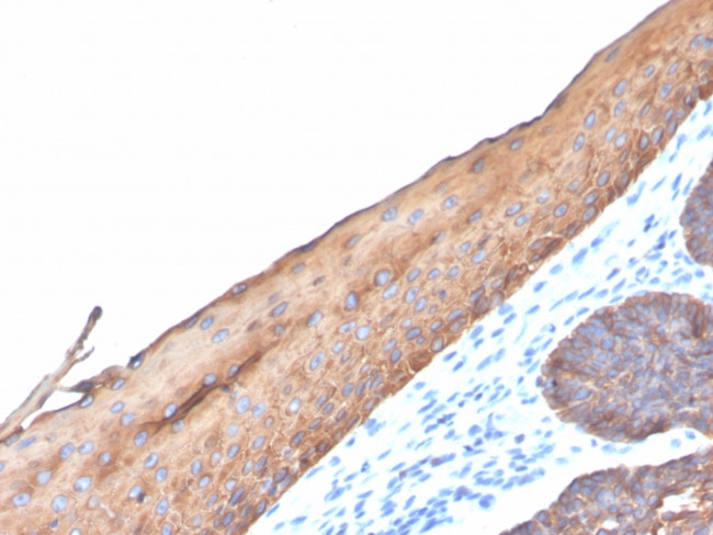 Cytokeratin, Type I (Epithelial Marker) Antibody in Immunohistochemistry (Paraffin) (IHC (P))