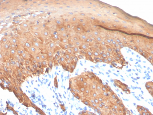 Cytokeratin, Type I (Epithelial Marker) Antibody in Immunohistochemistry (Paraffin) (IHC (P))