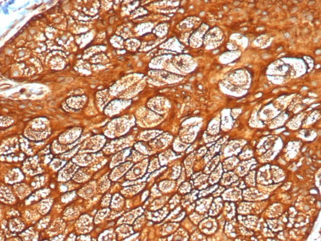 Cytokeratin, Type I (Epithelial Marker) Antibody in Immunohistochemistry (Paraffin) (IHC (P))