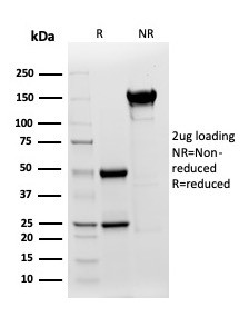 Cytokeratin, Type I (Epithelial Marker) Antibody in SDS-PAGE (SDS-PAGE)