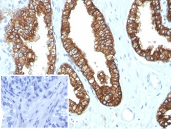 Cytokeratin 8/18 Antibody in Immunohistochemistry (Paraffin) (IHC (P))