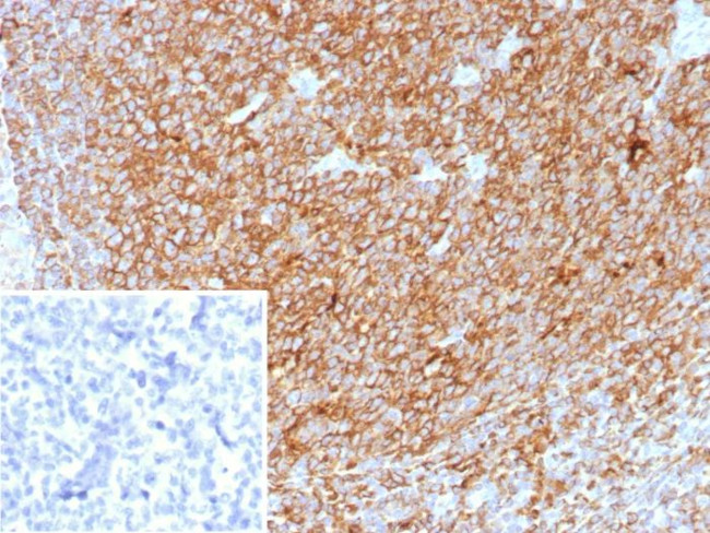 Pan-HLA-II (DP, DQ, DR) Antibody in Immunohistochemistry (Paraffin) (IHC (P))